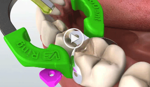 Click to watch the V3 in Action