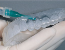 Deliver desensitizing gel into custom tray.